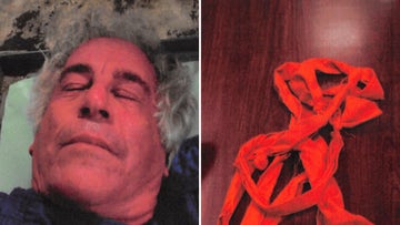 Newly Released Photos Reveal Epstein’s Injuries from 2019 Jail Incident