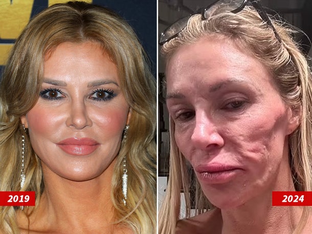 Brandi Glanville Face Mystery Solved!!!
