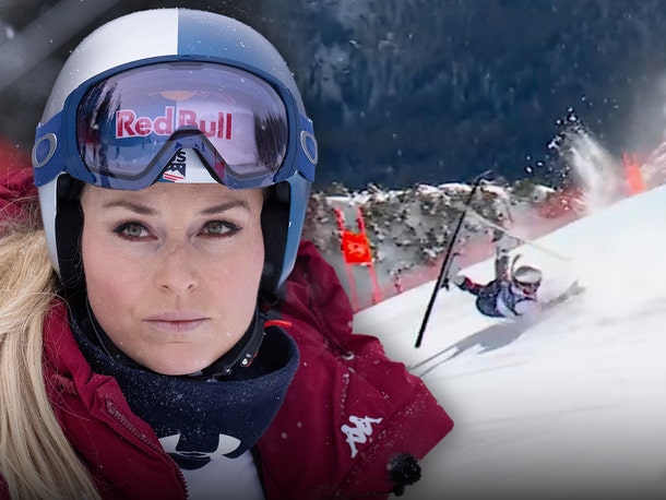 Lindsey Vonn Has Surgery for Broken Leg After Olympic Crash